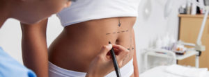 What Is the Difference Between a Mini-Tummy Tuck and a Full Tummy Tuck? | Austin, TX