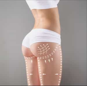Butt lift Austin TX | Butt Augmentation