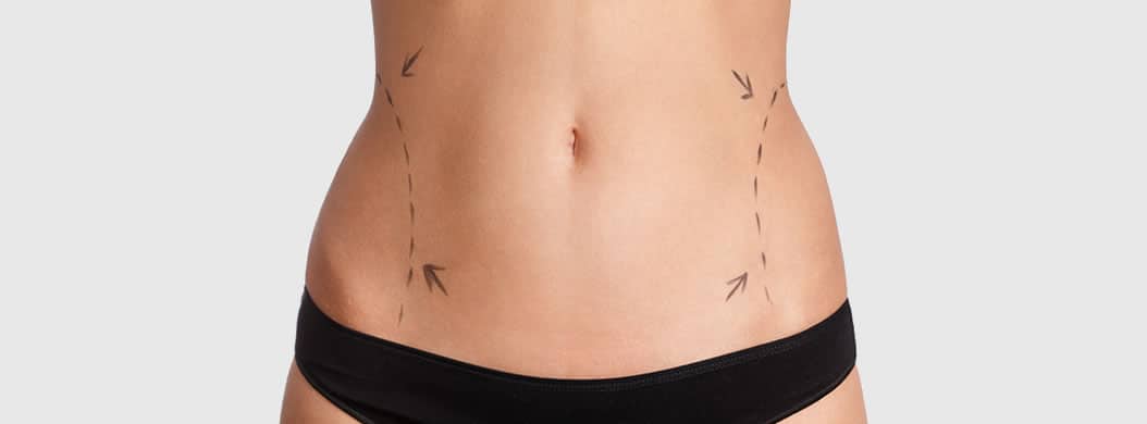 Liposuction in Austin, TX, Lipo Cost