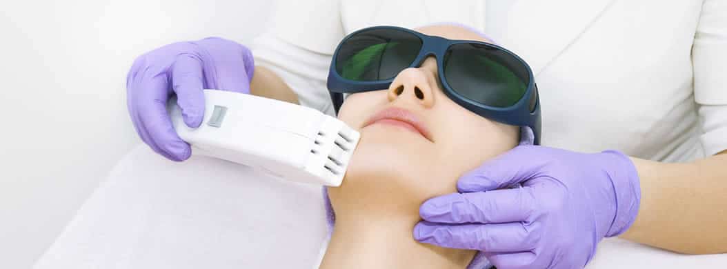 Laser skin resurfacing