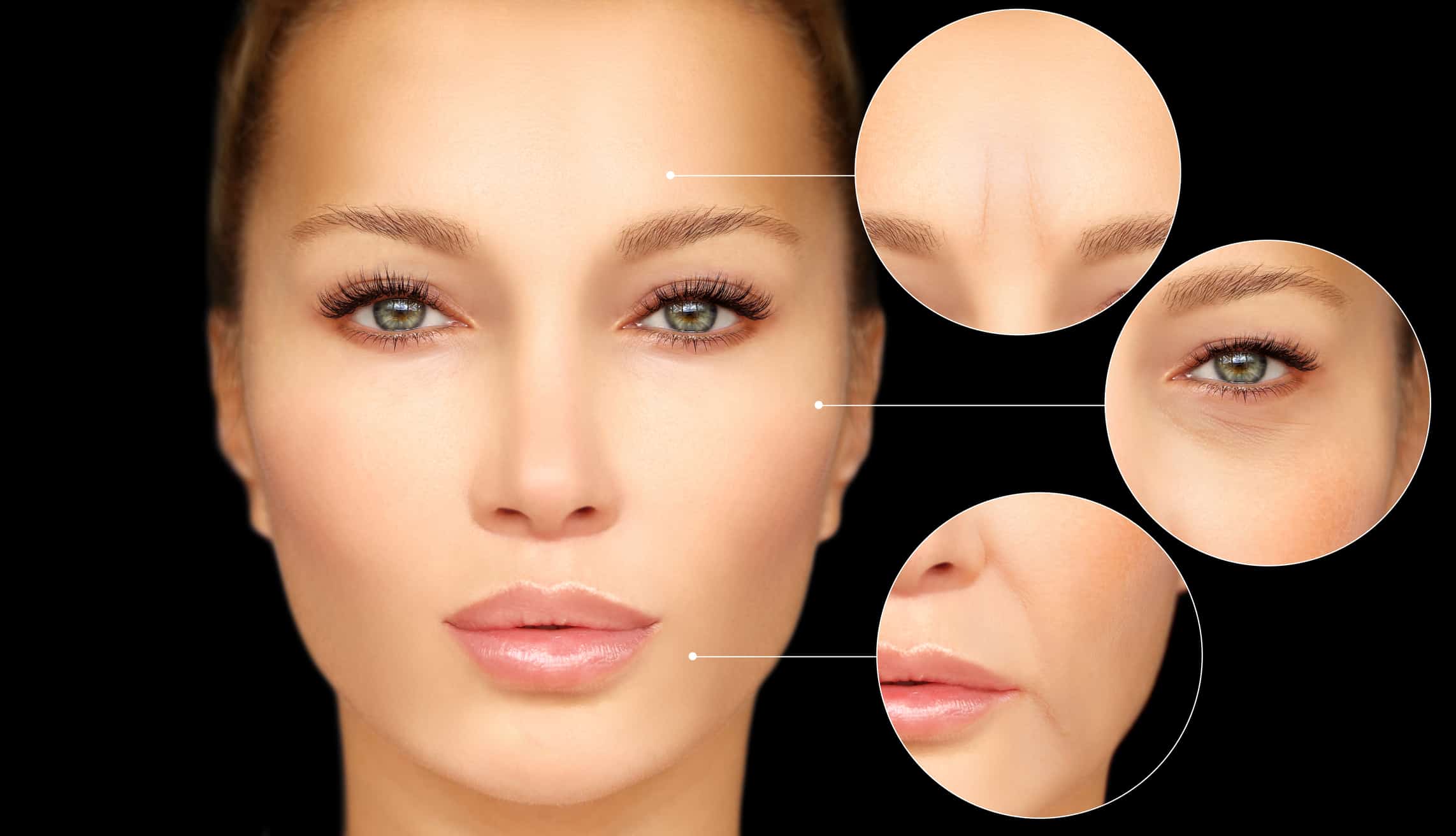 botox injectable expectations 1