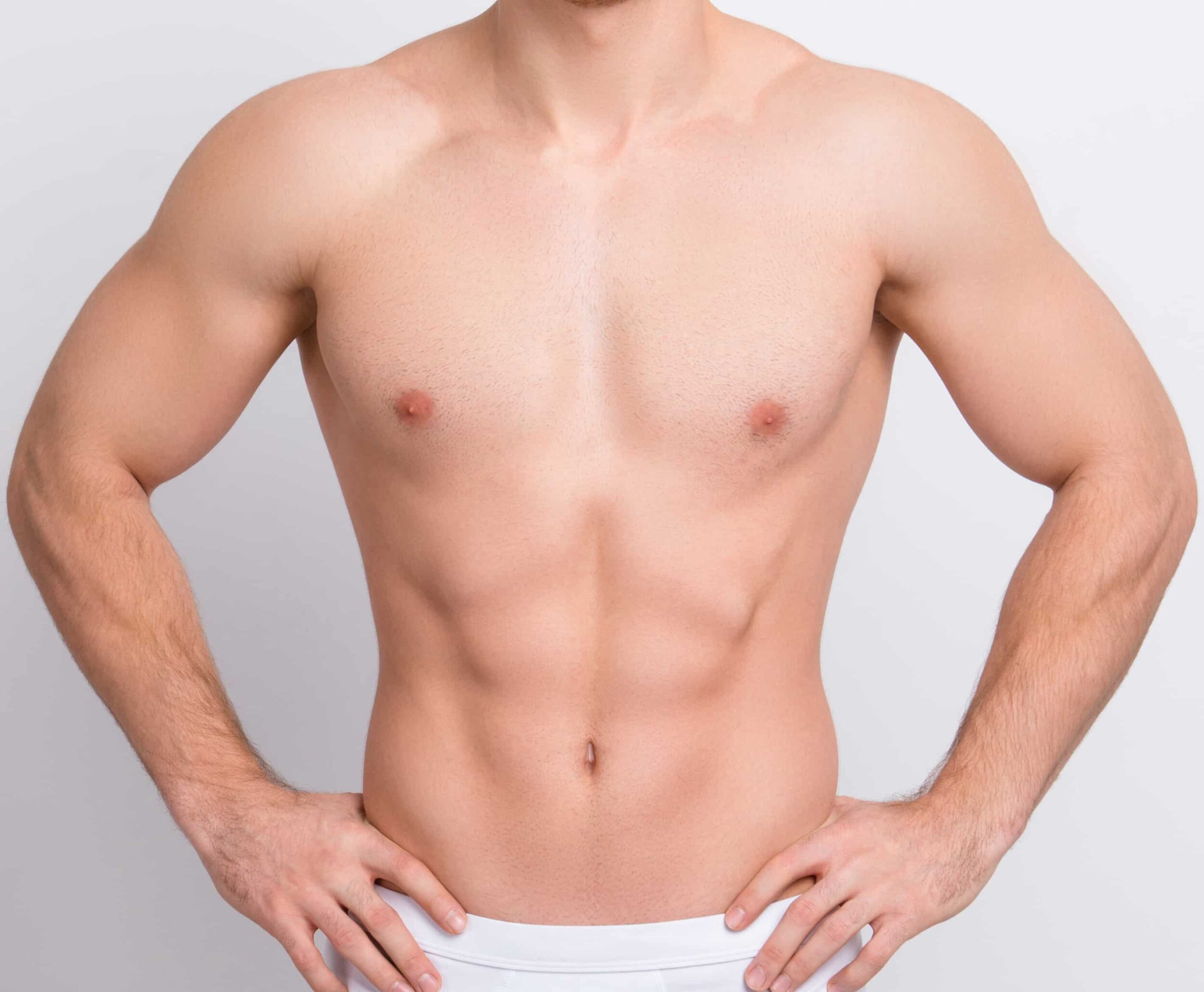 gynecomastia