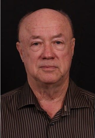 Before Image: Neck Lift - front