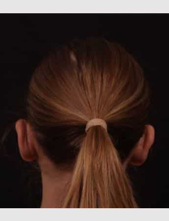 After Image