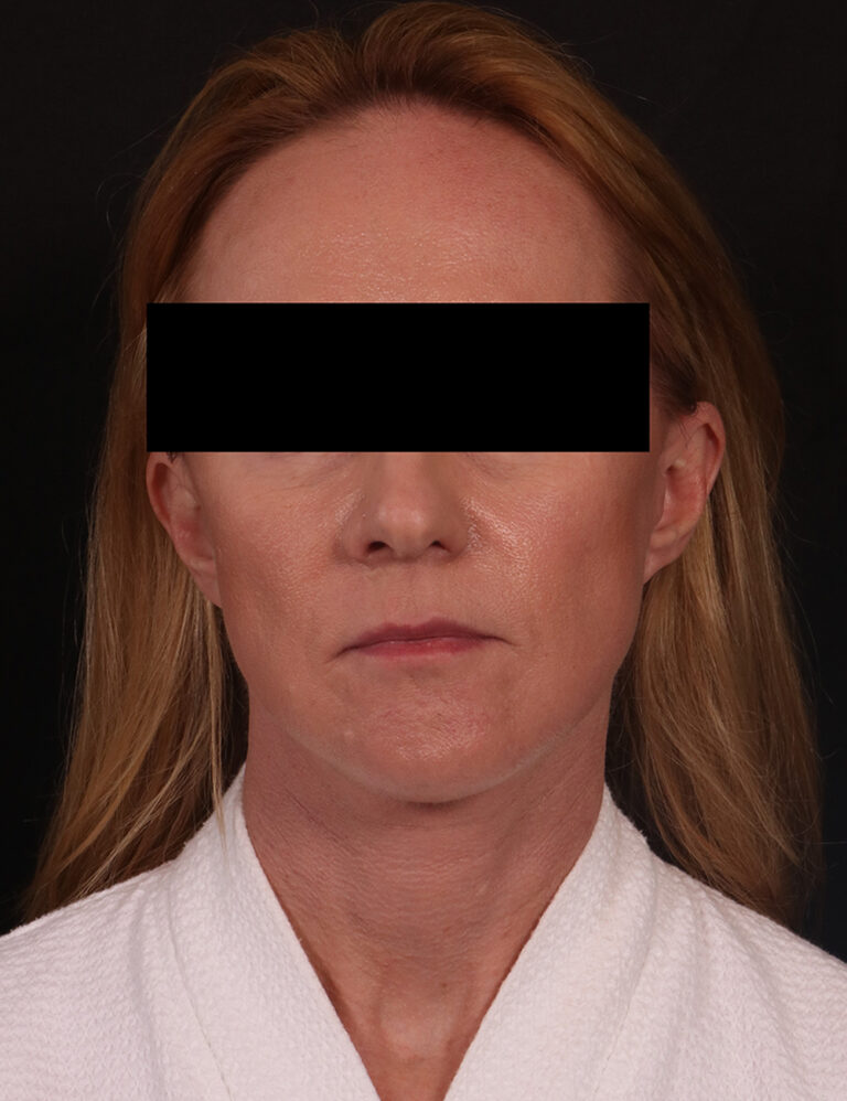 After Image