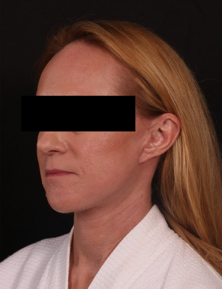 After Image