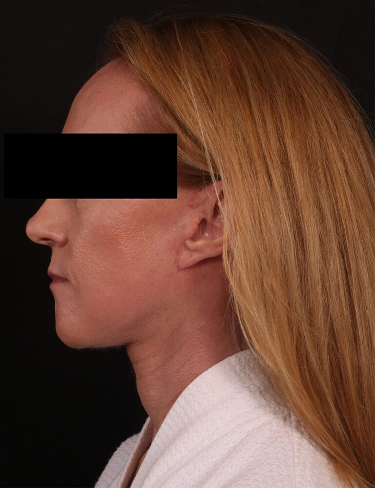 After Image