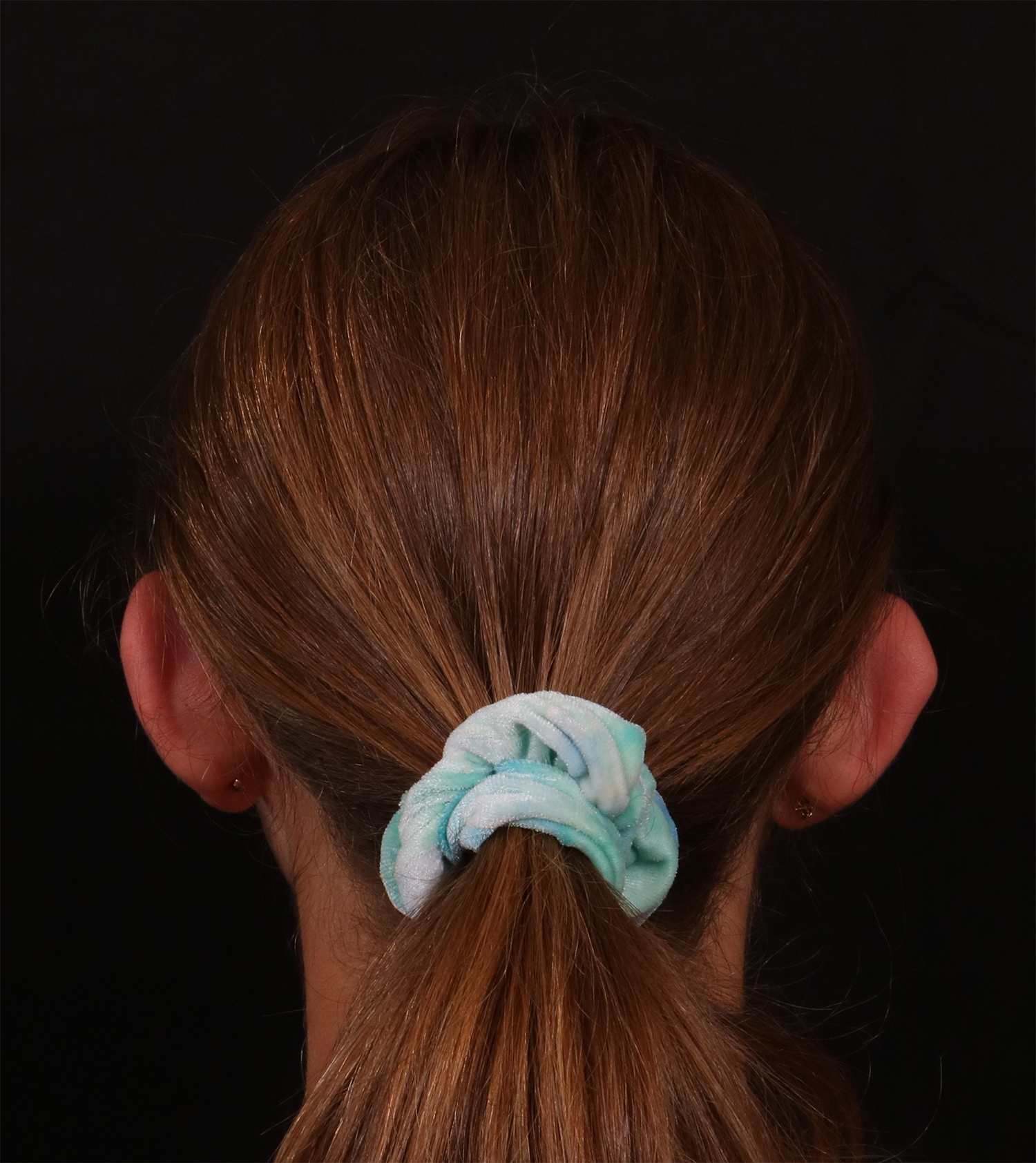 Before Image: Otoplasty - back